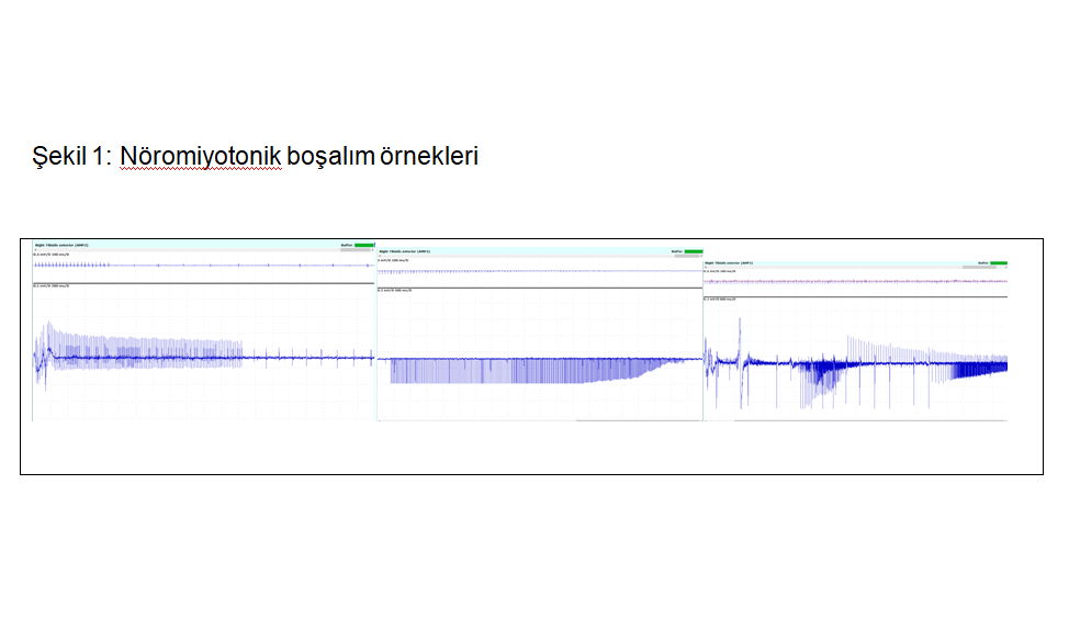 Şekil 1 Nöromiyotonik Boşalım Örnekleri